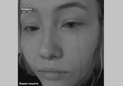 Химический ожог и &laquo;красные слезы&raquo;: жительница Татарстана пострадала после наращивания ресниц